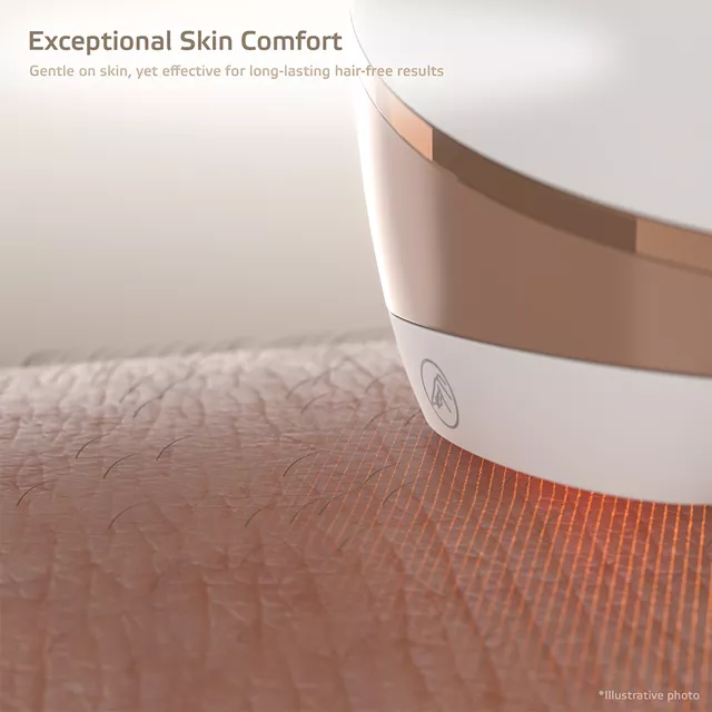 IPL epilátor inSPORTline Aphira