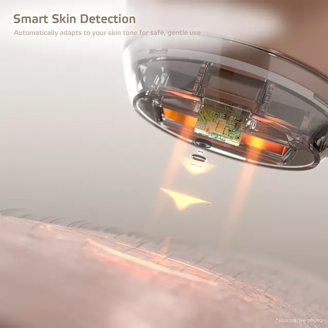 IPL epilátor inSPORTline Aphira